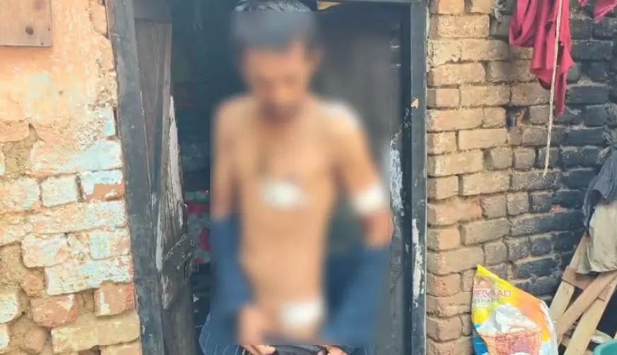 प्रेम विवाद खून में बदला: युवक ने बहन के भाई पर किया चाकू से हमला